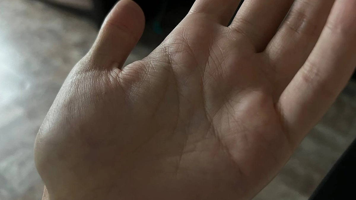 К чему чешется левая ладонь: к деньгам или к встрече? Разбираем примету с логической точки зрения