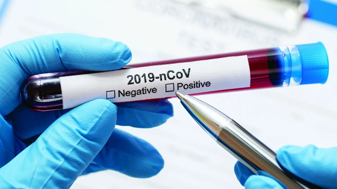 Главная картинка новости: Заболеваемость COVID-19 на Кубани опустилась ниже отметки сто человек в сутки