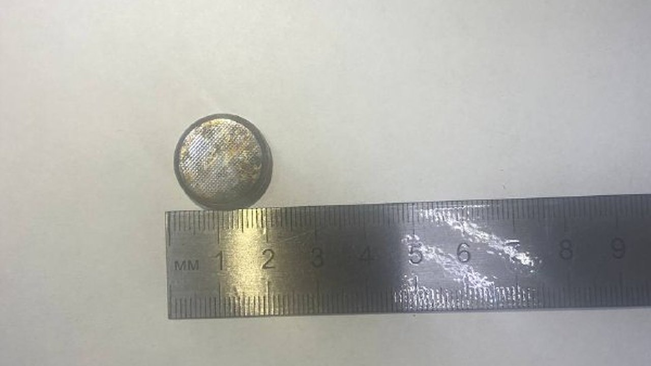 Главная картинка новости: В Новороссийске ребенок проглотил батарейку - ее достали врачи