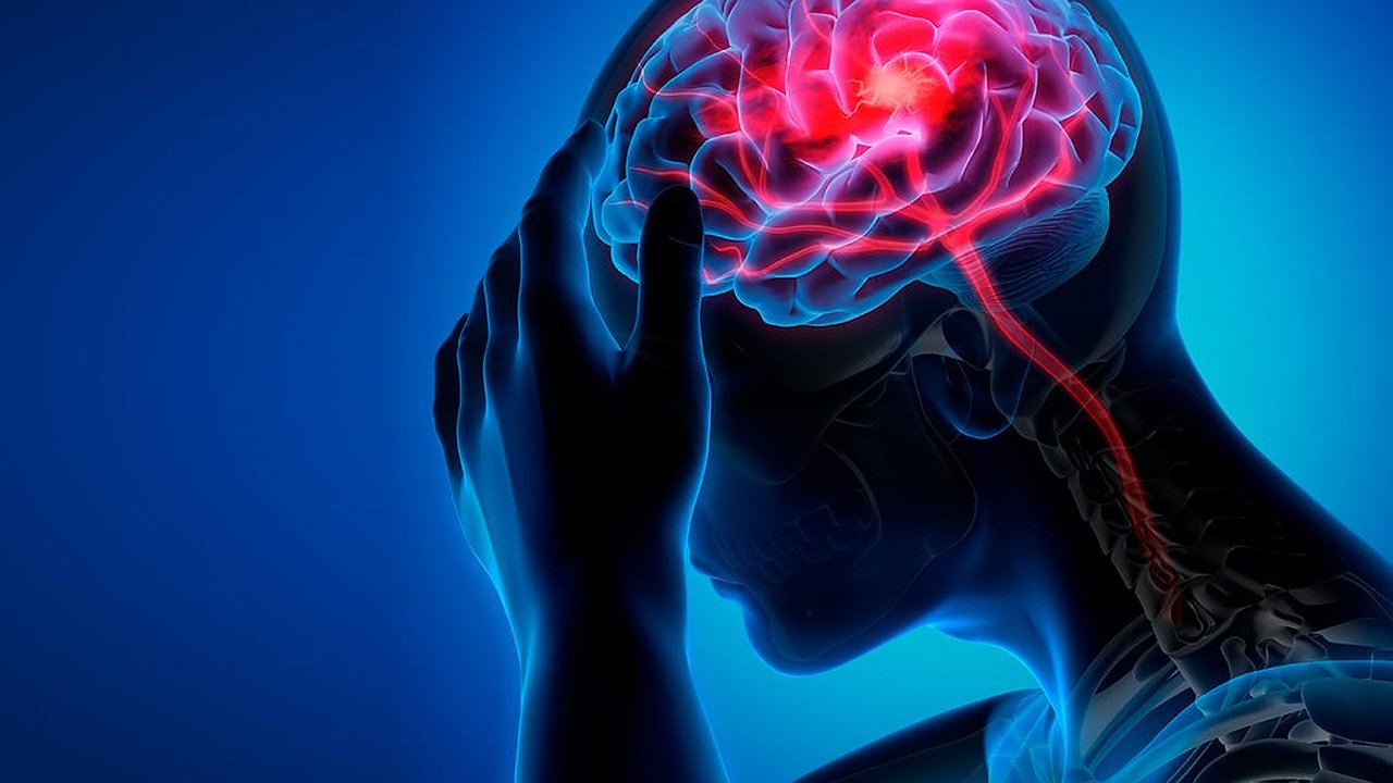 Главная картинка новости: Инсульт: виды и как распознать недуг