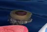 Миниатюра новости: В Черном море появились опасные «мозговые» медузы