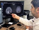 В Новороссийске врачи спасли женщину от инсульта благодаря своевременному вмешательству