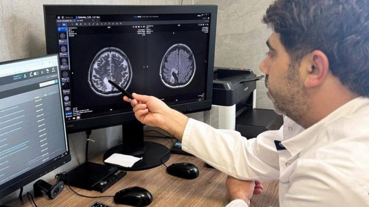 Главная картинка новости: В Новороссийске врачи спасли женщину от инсульта благодаря своевременному вмешательству