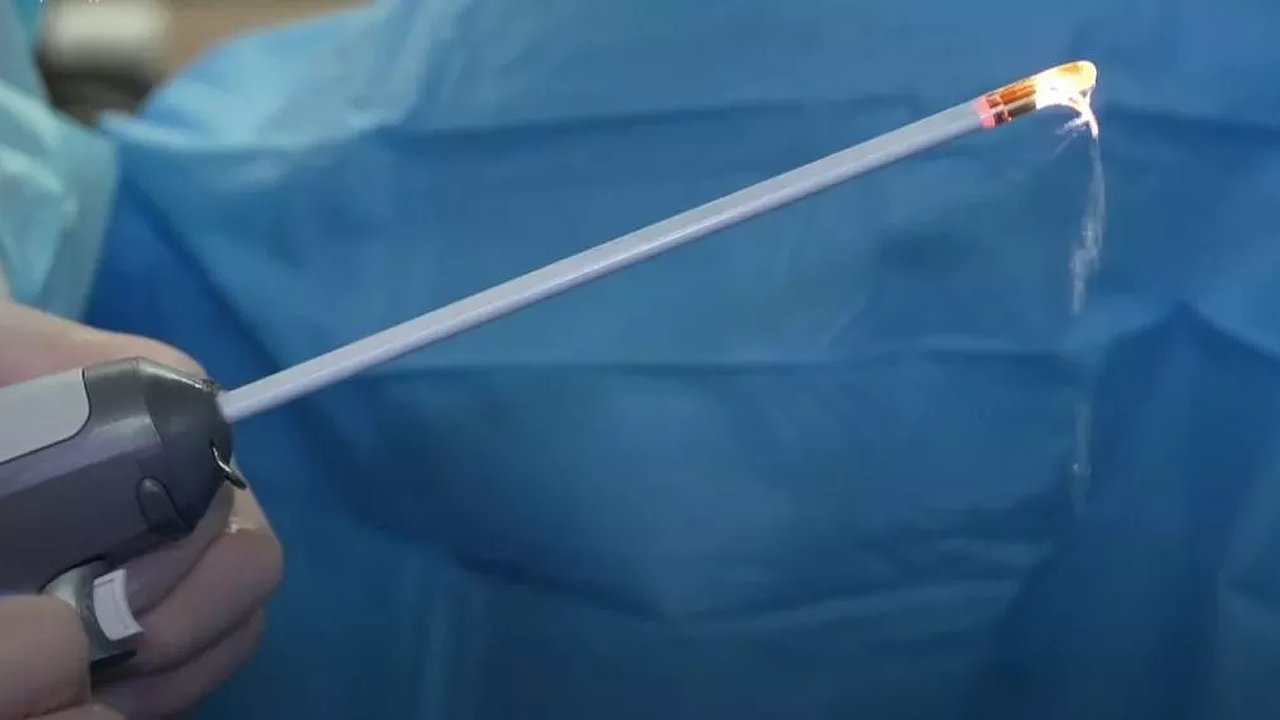 Главная картинка новости: Новороссийские врачи внедрили инновационный метод лечения аденомы простаты