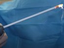 Новороссийские врачи внедрили инновационный метод лечения аденомы простаты