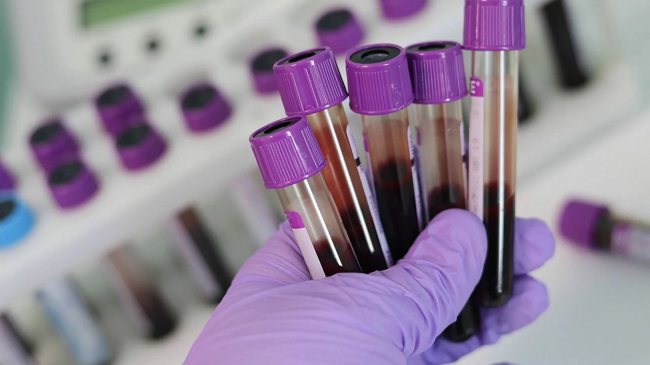 Главная картинка новости: Болезни не липнут: ученые выяснили: дети с этой группой крови – самые устойчивые