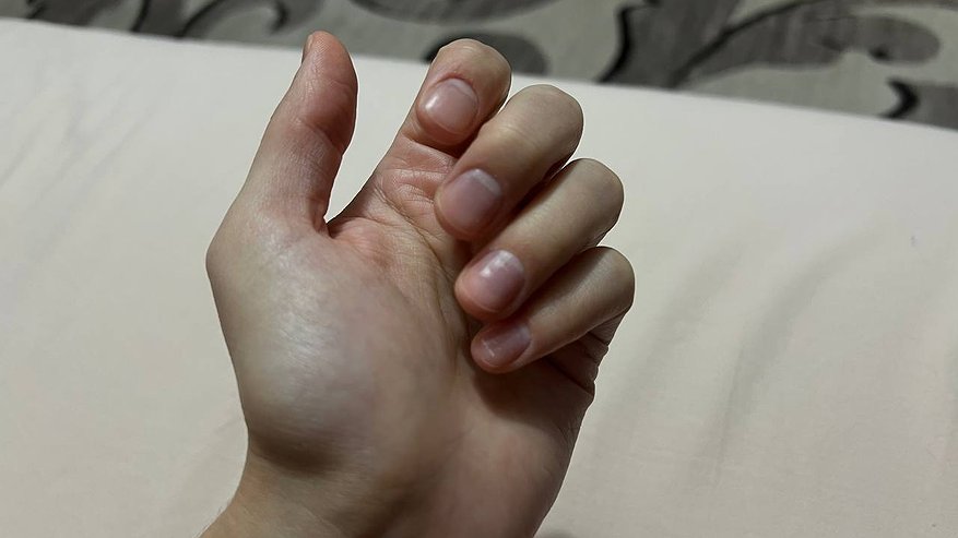 Главная картинка новости: Врач посмотрел на мои ногти и сразу сказал, чего не хватает организму: проверила — всё сошлось