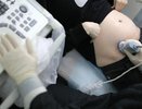 На Кубани одобрили в первом чтении законопроект о запрете склонения к абортам