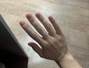 Ногти как индикатор здоровья: о каких болезнях говорят волны и полосы