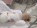 Перелом назвали царапиной: почему после наезда на девочку в Краснодаре не завели уголовное дело